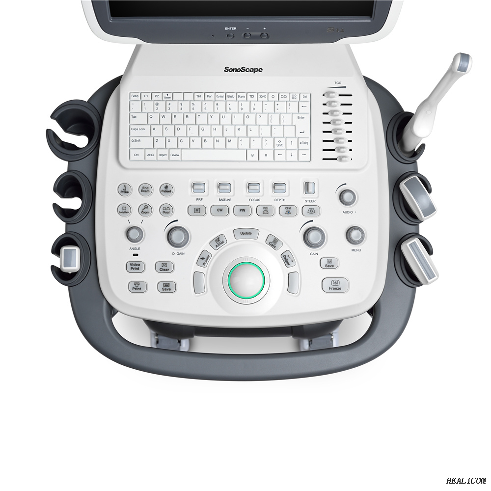 Escáner de ultrasonido Doppler a color con carro de ultrasonido digital completo Sonoscape S12 de alta calidad