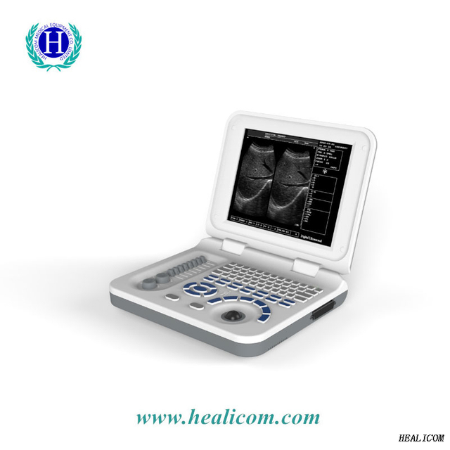 Equipo de diagnóstico HBW-3 Plus Ultrasonido portátil completamente digital portátil