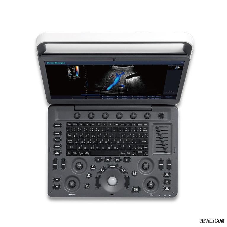 SonoScape E2 Professional Hospital utiliza un sistema de diagnóstico de máquina de ultrasonido Doppler color digital completo