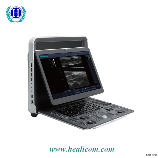 Sistema de escáner de ultrasonido portátil médico E1 Sonoscape precio de la máquina de sonda de ultrasonido en blanco y negro