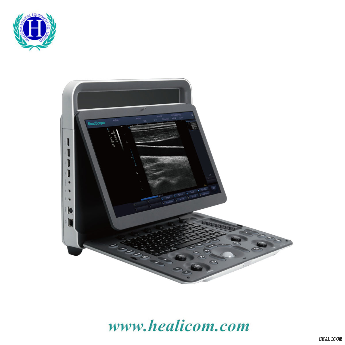 Sistema de escáner de ultrasonido portátil médico E1 Sonoscape precio de la máquina de sonda de ultrasonido en blanco y negro