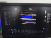 Equipo médico HUC-600P Escáner de ultrasonido Doppler color 4D tipo carro digital completo